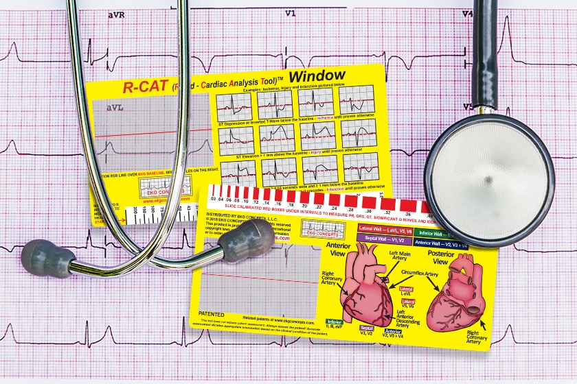 R-CAT Window EKG Educational Tool